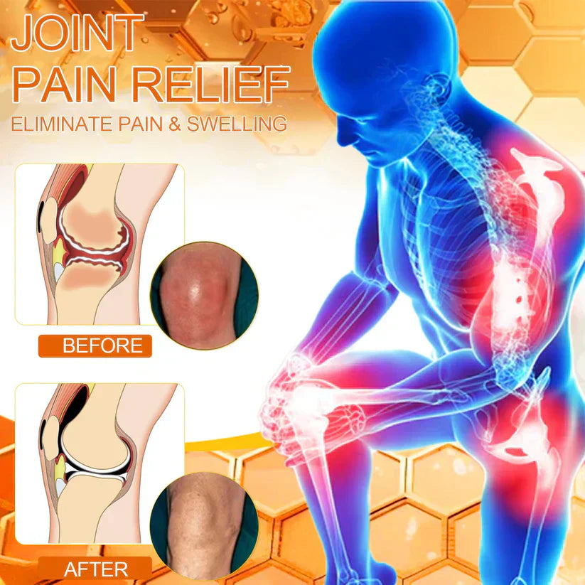 💦✅Official Store: flysmus™ Bee-Venom Pain-Relief Bone Healing Cream