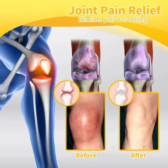 💦✅Official Store: flysmus™ Bee-Venom Pain-Relief Bone Healing Cream