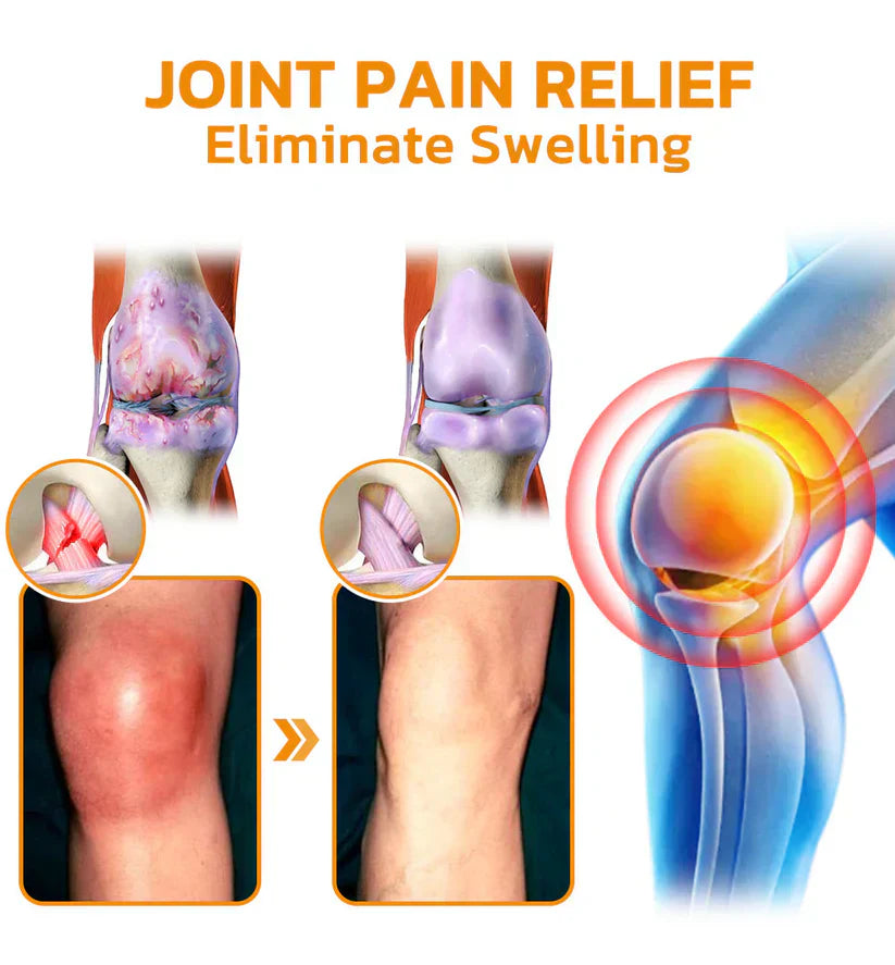 💦✅Official Store: flysmus™ Bee-Venom Pain-Relief Bone Healing Cream