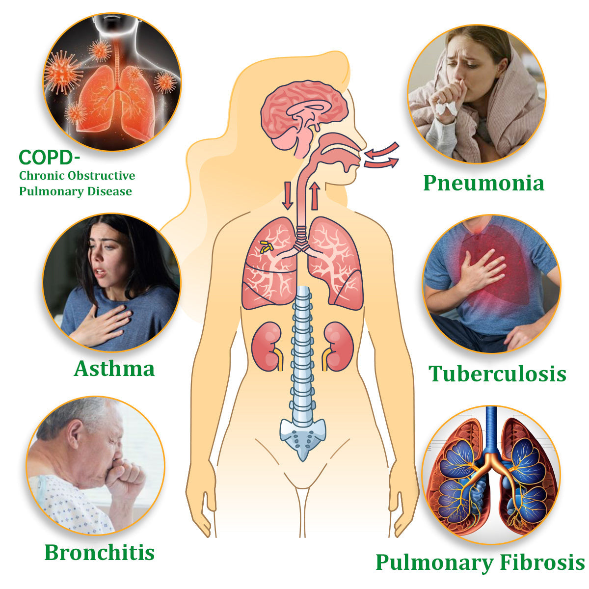 🍒✅Official Store:Ourlyard™ Herbal Lung Cleansing Inhaler 🫁MHRA Approved(💝 Cough, wheezing, shortness of breath, sputum, stuffy nose, bronchitis, bronchitis, allergy symptoms, lung discomfort💝)