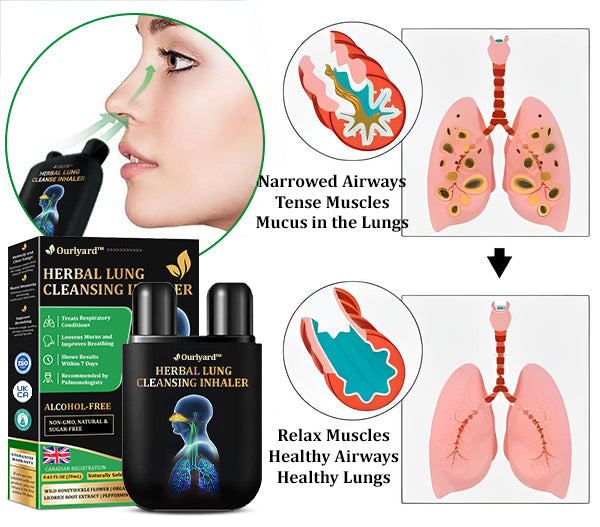 🍒✅Official Store:Ourlyard™ Herbal Lung Cleansing Inhaler 🫁MHRA Approved(💝 Cough, wheezing, shortness of breath, sputum, stuffy nose, bronchitis, bronchitis, allergy symptoms, lung discomfort💝)