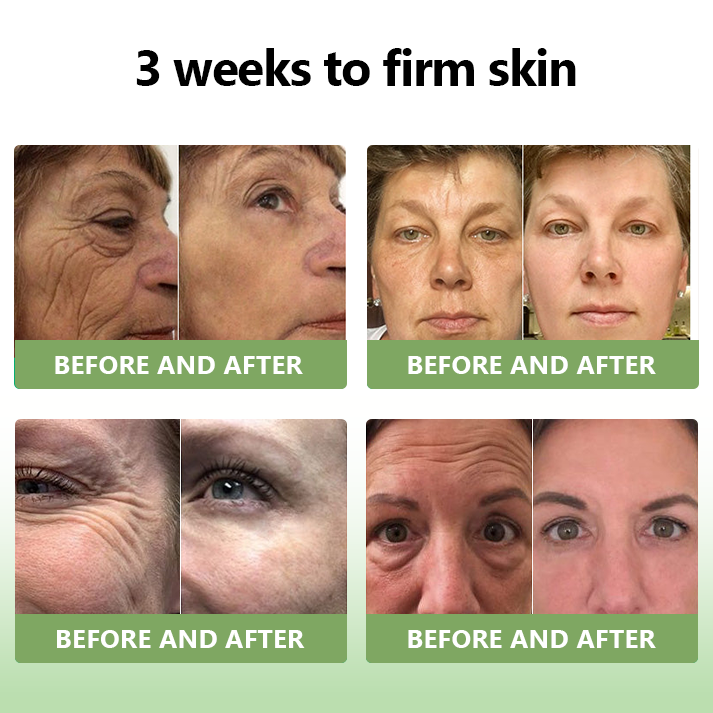 ✨🎋💐Flysmus™  𝑳𝒖𝒙𝒖𝒓𝒊𝒐𝒖𝒔 𝑪𝒐𝒍𝒍𝒂𝒈𝒆𝒏 𝑭𝒊𝒓𝒎𝒊𝒏𝒈 𝑪𝒓𝒆𝒂𝒎(🔥70% Off for a Limited Time!)