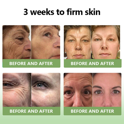 ✨🎋💐Flysmus™  𝑳𝒖𝒙𝒖𝒓𝒊𝒐𝒖𝒔 𝑪𝒐𝒍𝒍𝒂𝒈𝒆𝒏 𝑭𝒊𝒓𝒎𝒊𝒏𝒈 𝑪𝒓𝒆𝒂𝒎(🔥70% Off for a Limited Time!)