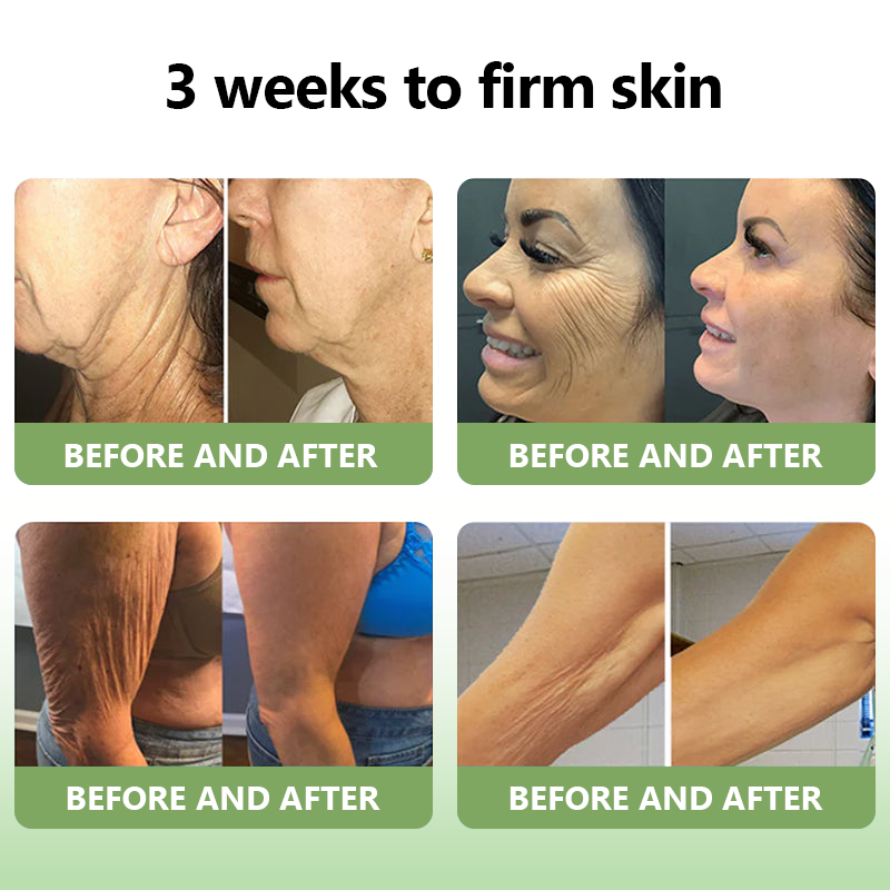 ✨🎋💐Flysmus™  𝑳𝒖𝒙𝒖𝒓𝒊𝒐𝒖𝒔 𝑪𝒐𝒍𝒍𝒂𝒈𝒆𝒏 𝑭𝒊𝒓𝒎𝒊𝒏𝒈 𝑪𝒓𝒆𝒂𝒎(🔥70% Off for a Limited Time!)