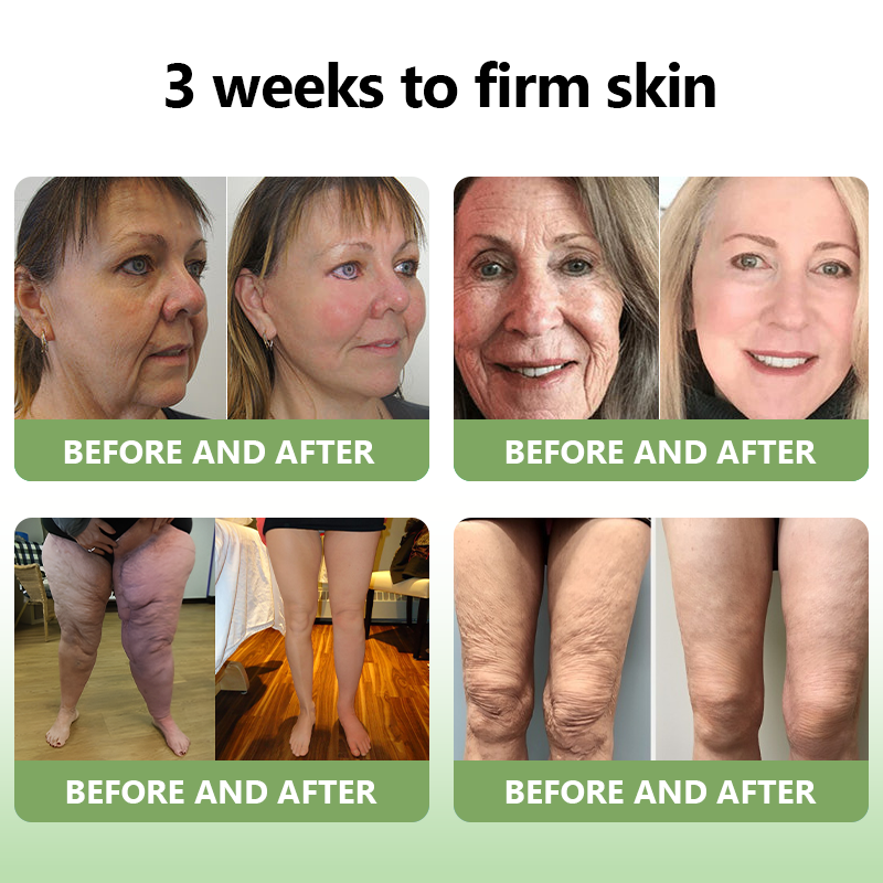 ✨🎋💐Flysmus™  𝑳𝒖𝒙𝒖𝒓𝒊𝒐𝒖𝒔 𝑪𝒐𝒍𝒍𝒂𝒈𝒆𝒏 𝑭𝒊𝒓𝒎𝒊𝒏𝒈 𝑪𝒓𝒆𝒂𝒎(🔥70% Off for a Limited Time!)