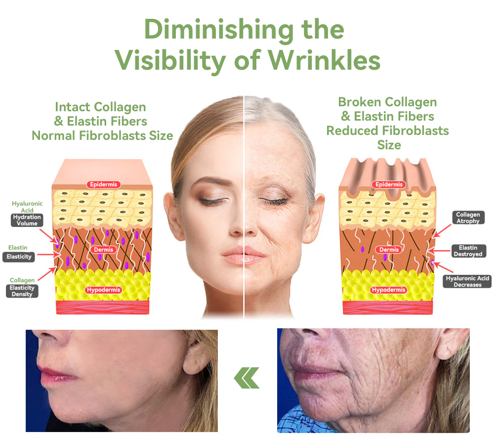 ✨🎋💐Flysmus™  𝑳𝒖𝒙𝒖𝒓𝒊𝒐𝒖𝒔 𝑪𝒐𝒍𝒍𝒂𝒈𝒆𝒏 𝑭𝒊𝒓𝒎𝒊𝒏𝒈 𝑪𝒓𝒆𝒂𝒎(🔥70% Off for a Limited Time!)