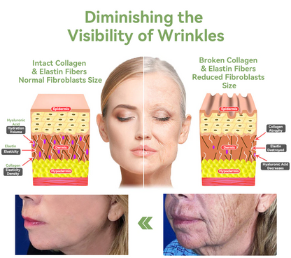 ✨🎋💐Flysmus™  𝑳𝒖𝒙𝒖𝒓𝒊𝒐𝒖𝒔 𝑪𝒐𝒍𝒍𝒂𝒈𝒆𝒏 𝑭𝒊𝒓𝒎𝒊𝒏𝒈 𝑪𝒓𝒆𝒂𝒎(🔥70% Off for a Limited Time!)