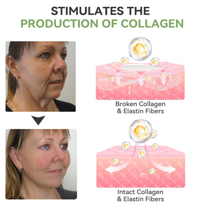 ✨🎋💐Flysmus™  𝑳𝒖𝒙𝒖𝒓𝒊𝒐𝒖𝒔 𝑪𝒐𝒍𝒍𝒂𝒈𝒆𝒏 𝑭𝒊𝒓𝒎𝒊𝒏𝒈 𝑪𝒓𝒆𝒂𝒎(🔥70% Off for a Limited Time!)