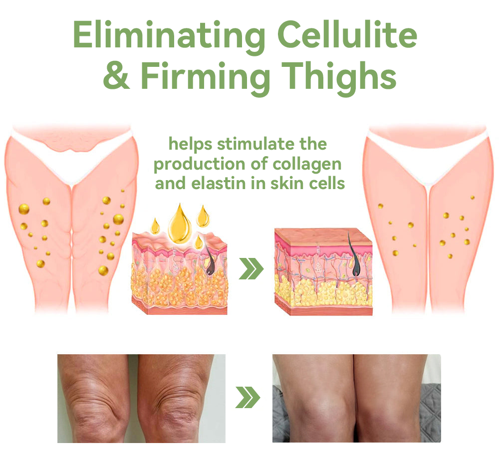 ✨🎋💐Flysmus™  𝑳𝒖𝒙𝒖𝒓𝒊𝒐𝒖𝒔 𝑪𝒐𝒍𝒍𝒂𝒈𝒆𝒏 𝑭𝒊𝒓𝒎𝒊𝒏𝒈 𝑪𝒓𝒆𝒂𝒎(🔥70% Off for a Limited Time!)