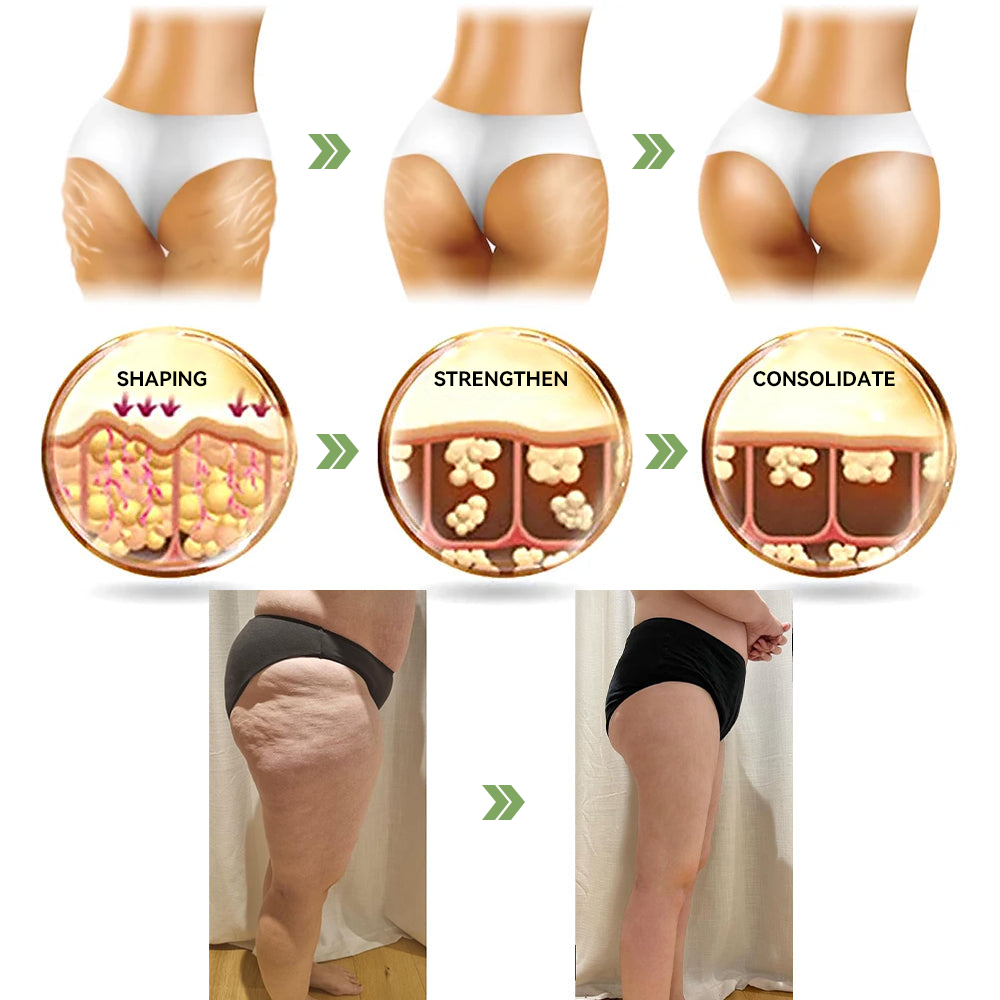 ✨🎋💐Flysmus™  𝑳𝒖𝒙𝒖𝒓𝒊𝒐𝒖𝒔 𝑪𝒐𝒍𝒍𝒂𝒈𝒆𝒏 𝑭𝒊𝒓𝒎𝒊𝒏𝒈 𝑪𝒓𝒆𝒂𝒎(🔥70% Off for a Limited Time!)